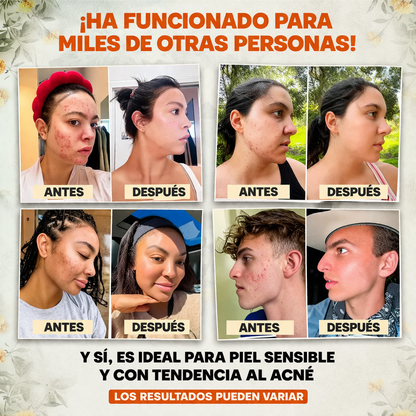 Bálsamo EVIL GOODS! - El Secreto Natural para Transformar tu Piel