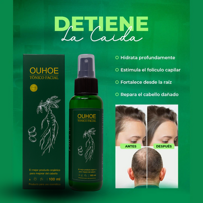 TONICO OUHOE 100ML PARA CABELLO