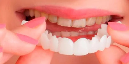 Carillas dentales cosmética Snapon Smile