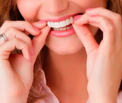 Carillas dentales cosmética Snapon Smile